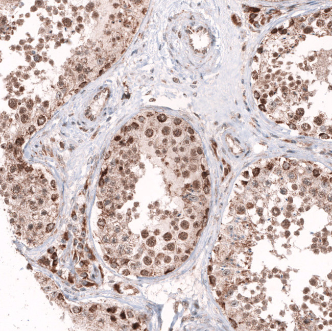 AFF2 Antibody in Immunohistochemistry (Paraffin) (IHC (P))