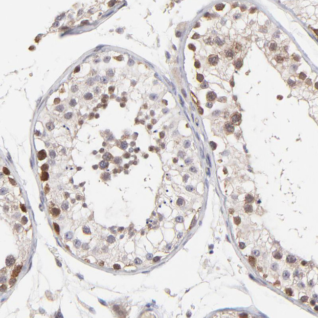 ZNF177 Antibody in Immunohistochemistry (IHC)