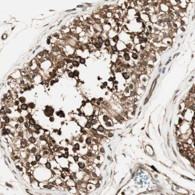 ZNF443 Antibody in Immunohistochemistry (Paraffin) (IHC (P))