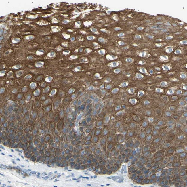 ZNF558 Antibody in Immunohistochemistry (Paraffin) (IHC (P))