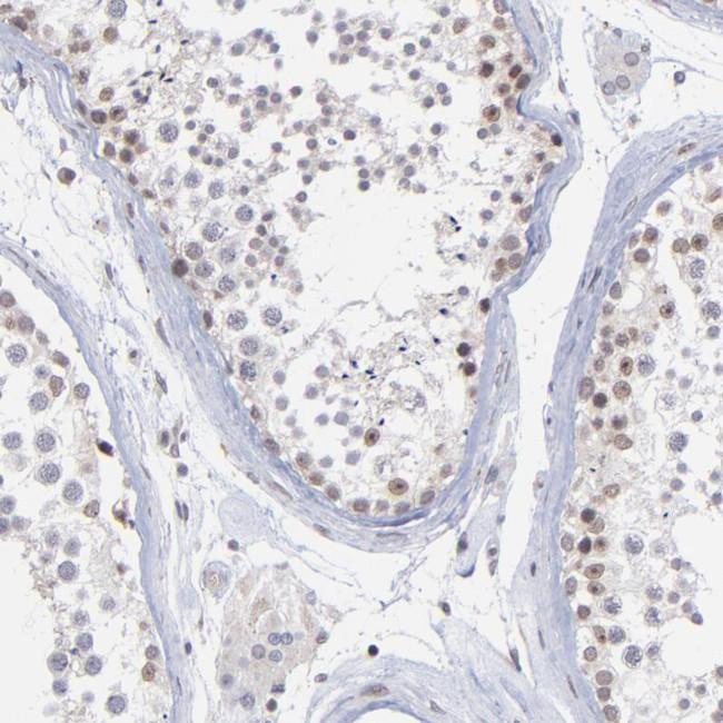 ZNF773 Antibody in Immunohistochemistry (Paraffin) (IHC (P))
