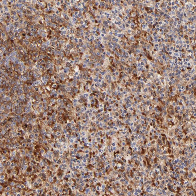 FRMPD3 Antibody in Immunohistochemistry (Paraffin) (IHC (P))