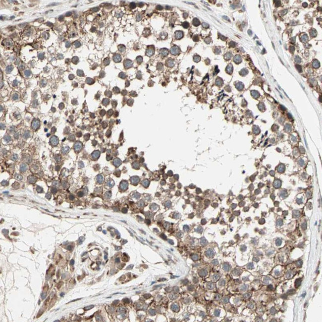 ZNF37A Antibody in Immunohistochemistry (Paraffin) (IHC (P))