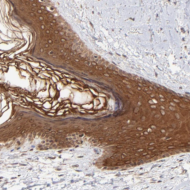 TNRC6B Antibody in Immunohistochemistry (Paraffin) (IHC (P))