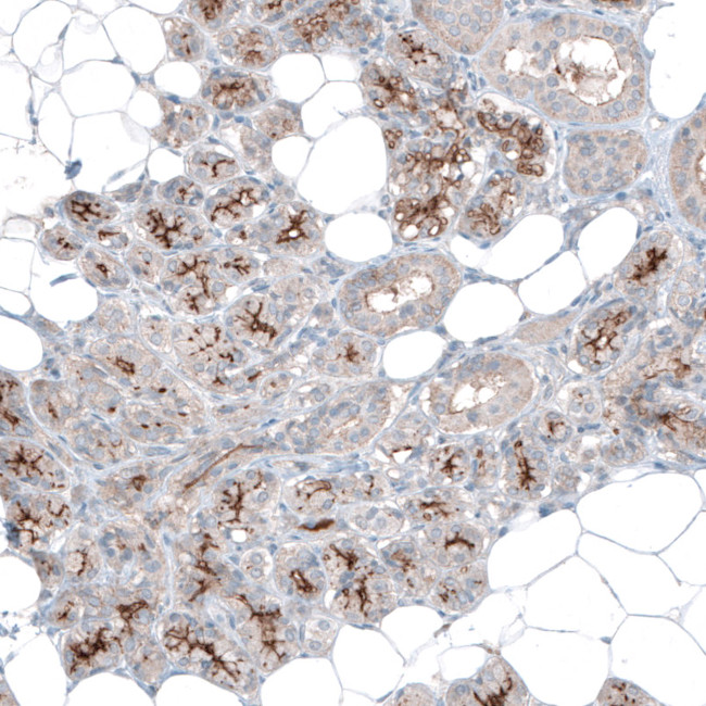 SLC6A14 Antibody in Immunohistochemistry (Paraffin) (IHC (P))