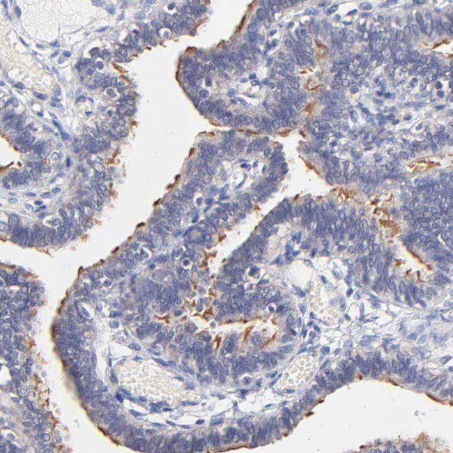 RIBC2 Antibody in Immunohistochemistry (Paraffin) (IHC (P))
