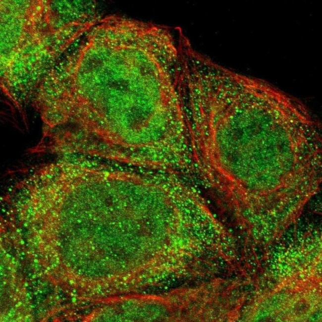 ZNF155 Antibody in Immunocytochemistry (ICC/IF)