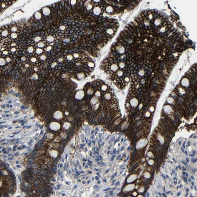 ZNF90 Antibody in Immunohistochemistry (Paraffin) (IHC (P))