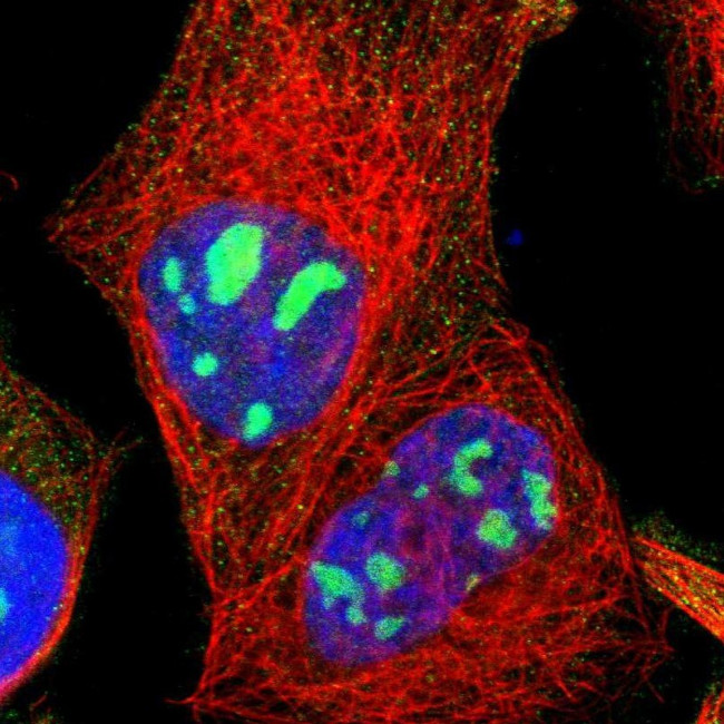 LRCH2 Antibody in Immunocytochemistry (ICC/IF)