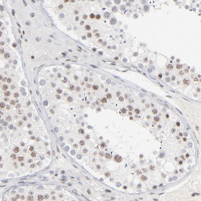 ZNF143 Antibody in Immunohistochemistry (Paraffin) (IHC (P))
