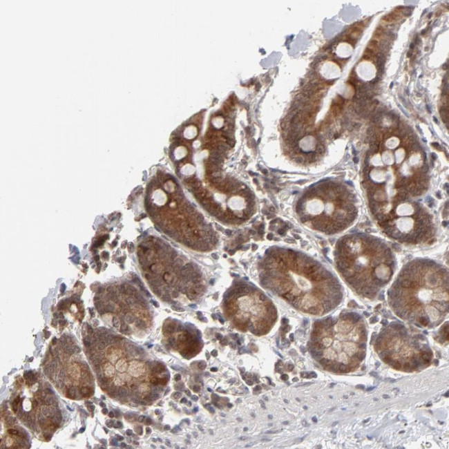 ARIH1 Antibody in Immunohistochemistry (Paraffin) (IHC (P))