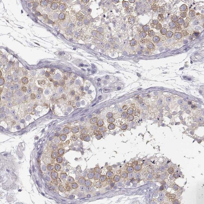 RBM44 Antibody in Immunohistochemistry (IHC)