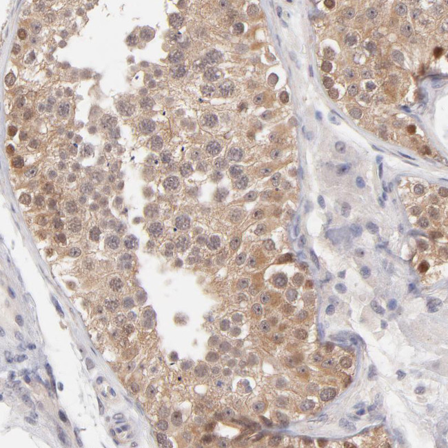 UBE2E3 Antibody in Immunohistochemistry (Paraffin) (IHC (P))