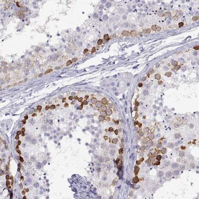 RHOXF2 Antibody in Immunohistochemistry (IHC)