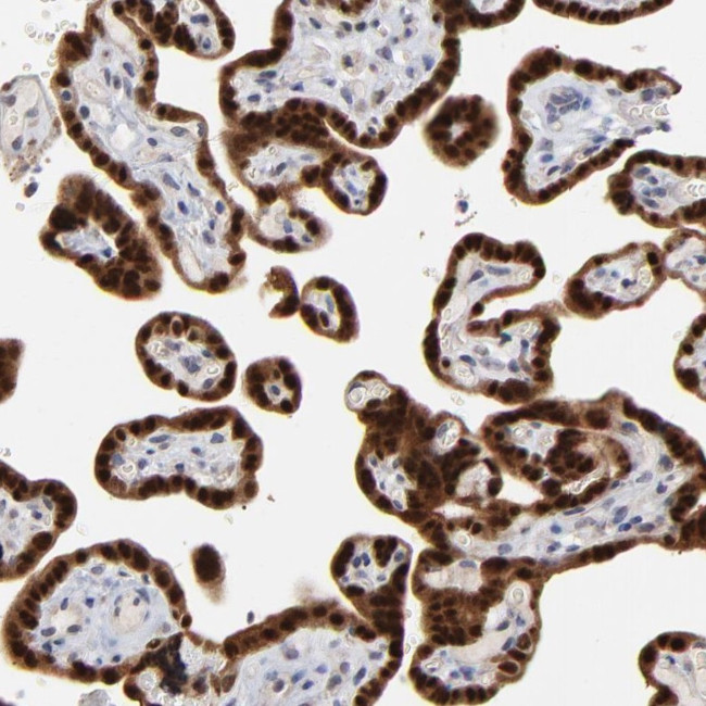 MAGEA10 Antibody in Immunohistochemistry (Paraffin) (IHC (P))