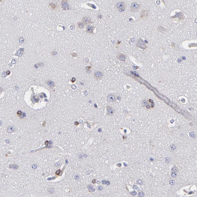 MOSPD2 Antibody in Immunohistochemistry (Paraffin) (IHC (P))