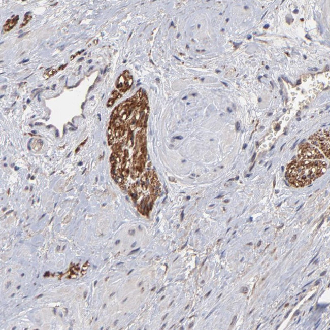 CHL1 Antibody in Immunohistochemistry (Paraffin) (IHC (P))