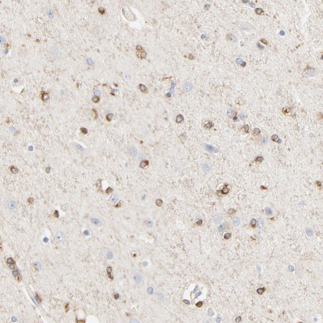 SH3KBP1 Antibody in Immunohistochemistry (Paraffin) (IHC (P))
