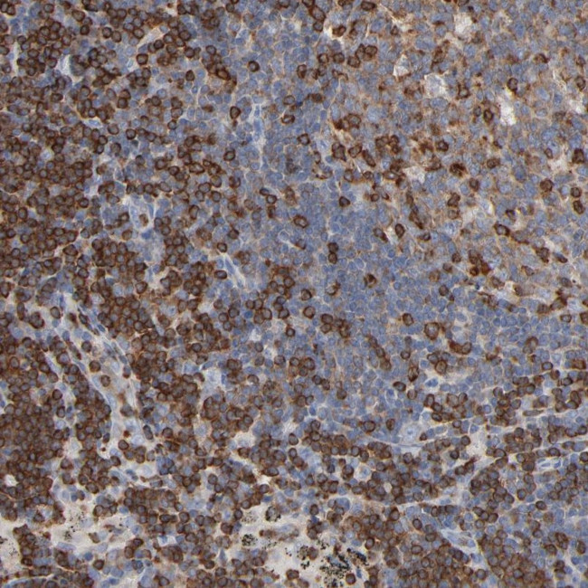 SH3KBP1 Antibody in Immunohistochemistry (Paraffin) (IHC (P))