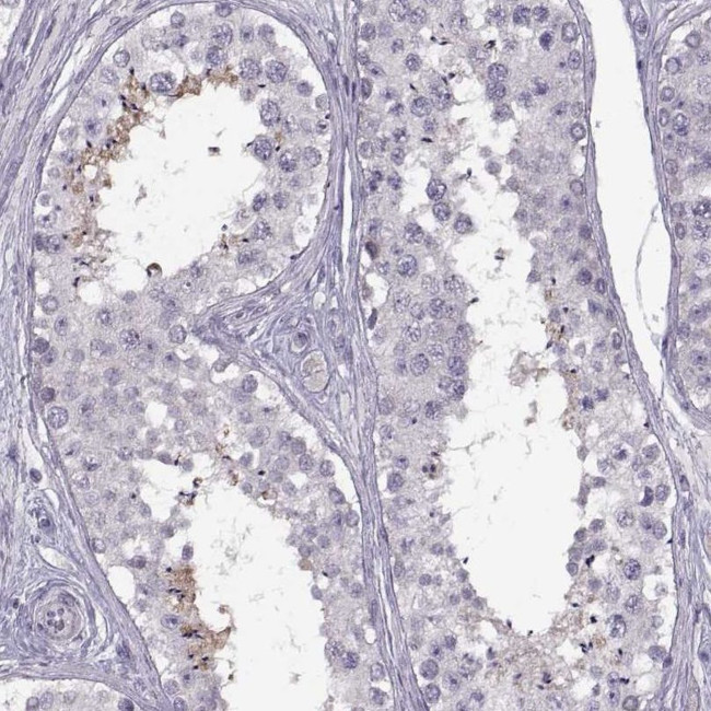 HYPM Antibody in Immunohistochemistry (IHC)