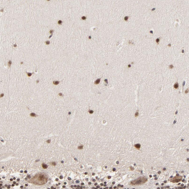 BRPF1 Antibody in Immunohistochemistry (Paraffin) (IHC (P))