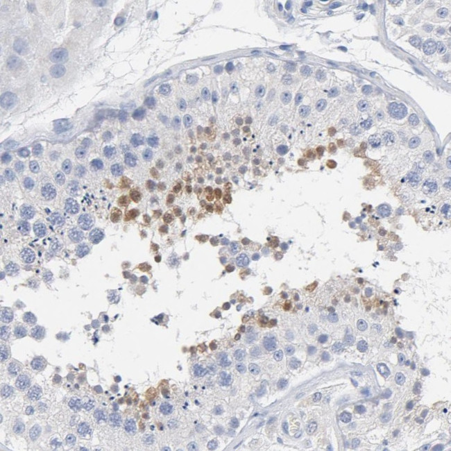 ZCCHC13 Antibody in Immunohistochemistry (Paraffin) (IHC (P))