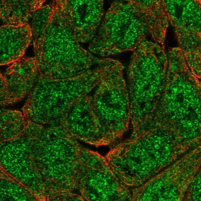 KIAA0323 Antibody in Immunocytochemistry (ICC/IF)