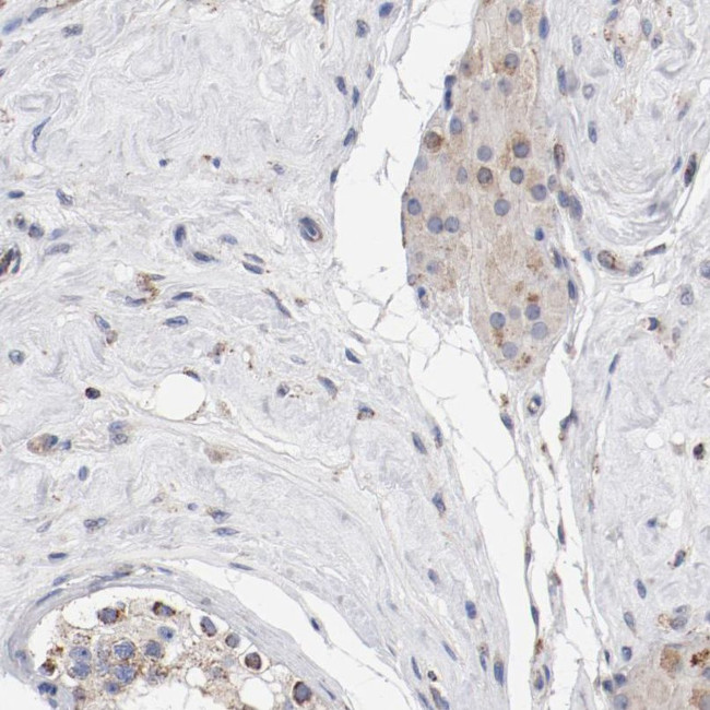NDUFV2 Antibody in Immunohistochemistry (IHC)