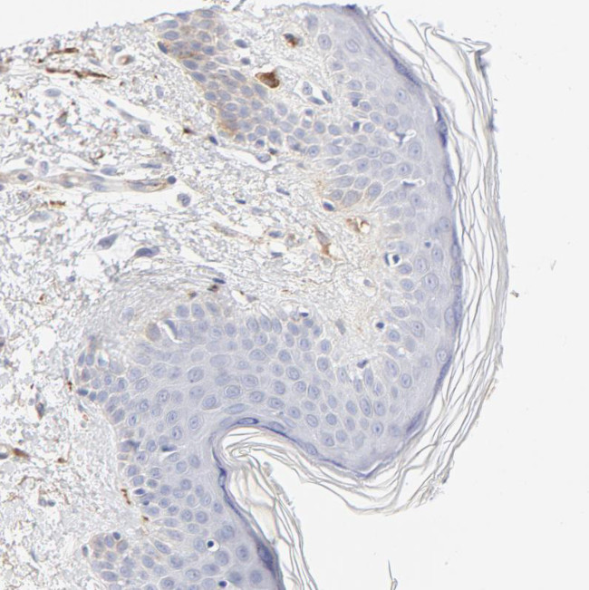 tPA Antibody in Immunohistochemistry (Paraffin) (IHC (P))