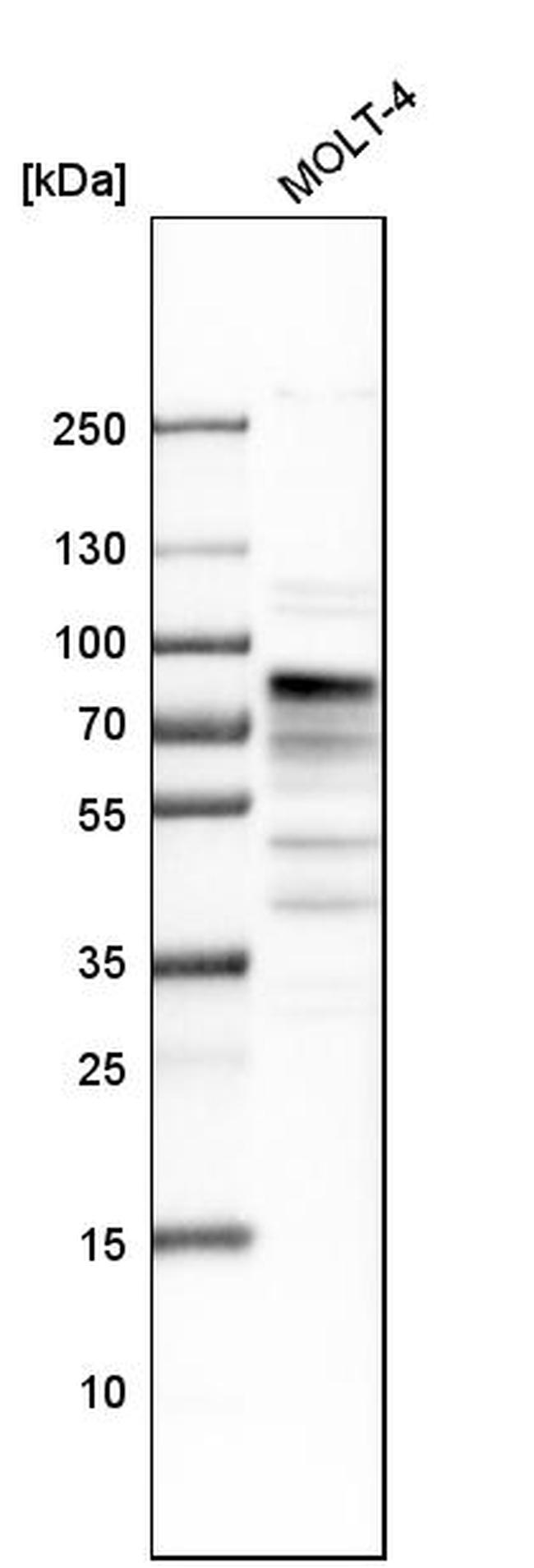 MSL2 Antibody in Western Blot (WB)