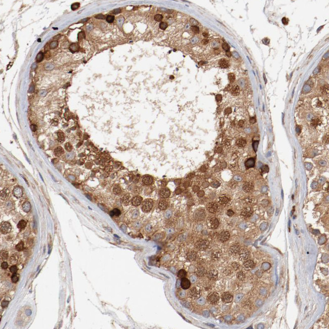 PITPNM2 Antibody in Immunohistochemistry (Paraffin) (IHC (P))