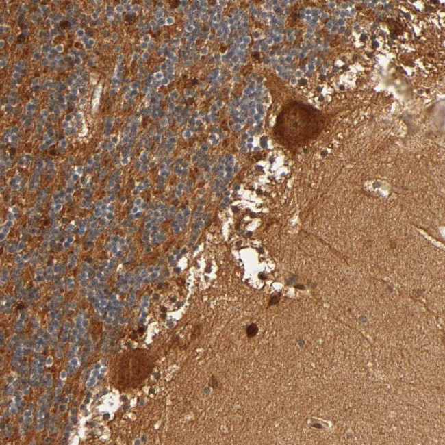 IQCJ-SCHIP1 Antibody in Immunohistochemistry (Paraffin) (IHC (P))