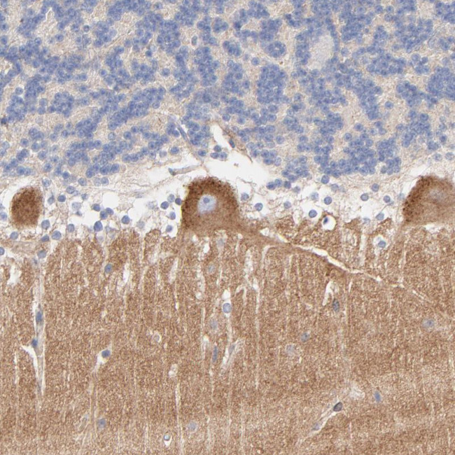SEPT6 Antibody in Immunohistochemistry (Paraffin) (IHC (P))