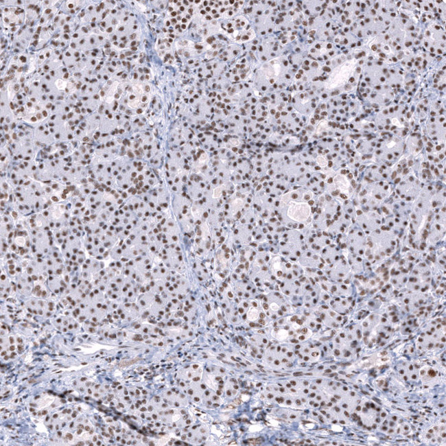 SNRPB Antibody in Immunohistochemistry (Paraffin) (IHC (P))