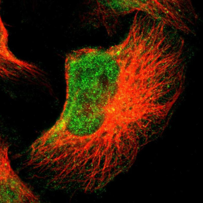 FOXN2 Antibody in Immunocytochemistry (ICC/IF)