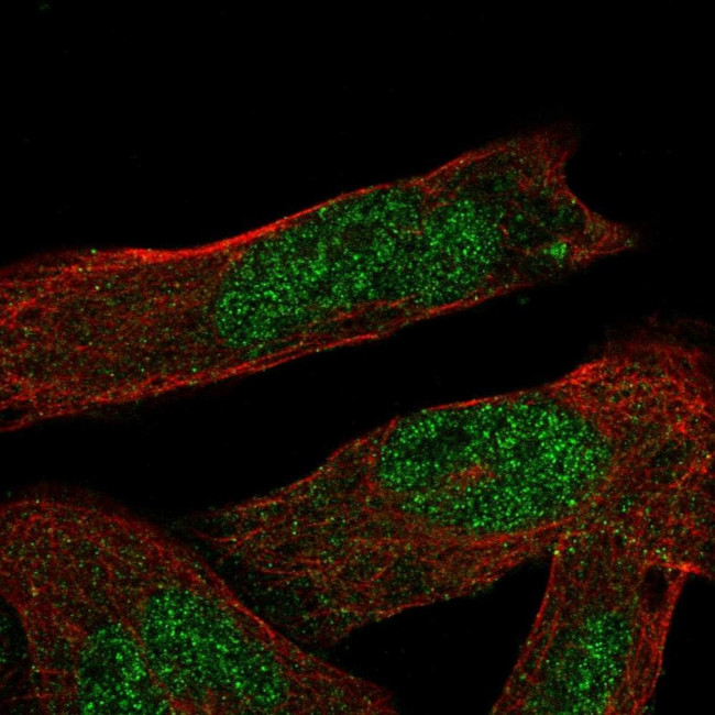 ASB1 Antibody in Immunocytochemistry (ICC/IF)