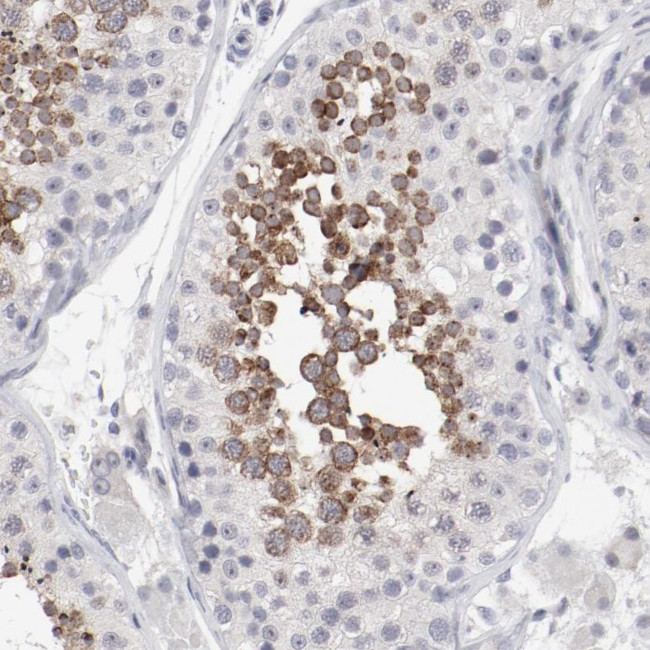 FSCB Antibody in Immunohistochemistry (Paraffin) (IHC (P))