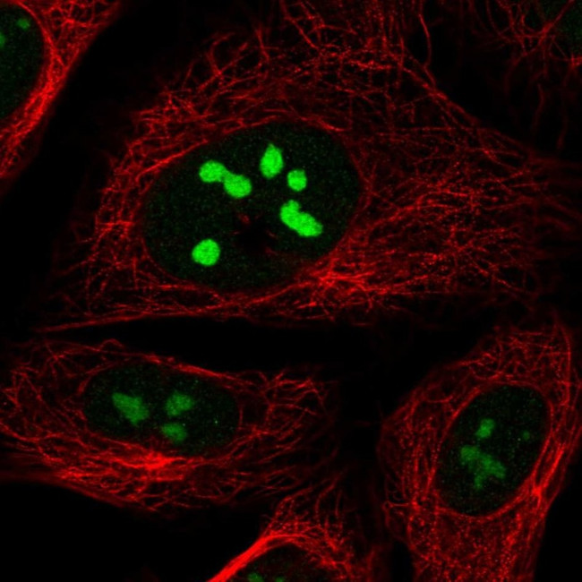 Nop25 Antibody in Immunocytochemistry (ICC/IF)