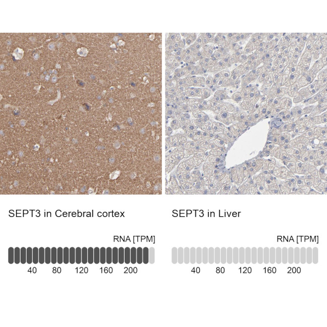 Septin 3 Antibody in Immunohistochemistry (IHC)