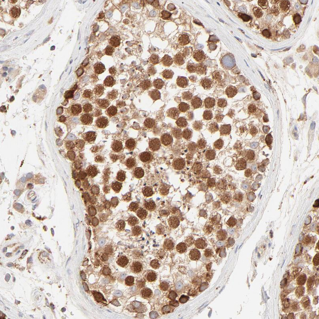 PARP12 Antibody in Immunohistochemistry (Paraffin) (IHC (P))