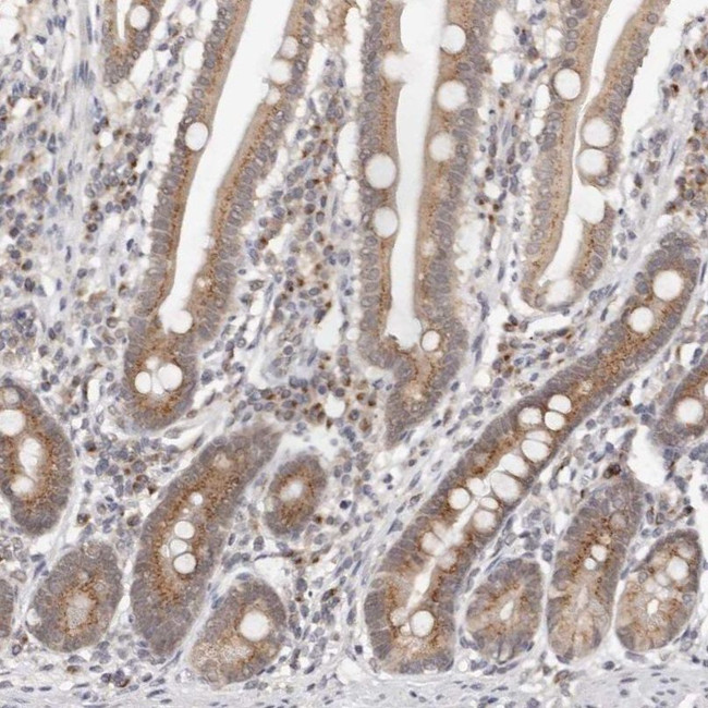 VIPAS39 Antibody in Immunohistochemistry (IHC)