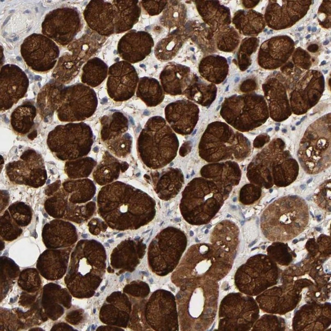 NDRG2 Antibody in Immunohistochemistry (IHC)