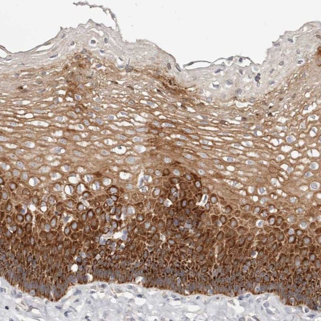 VIPAS39 Antibody in Immunohistochemistry (IHC)