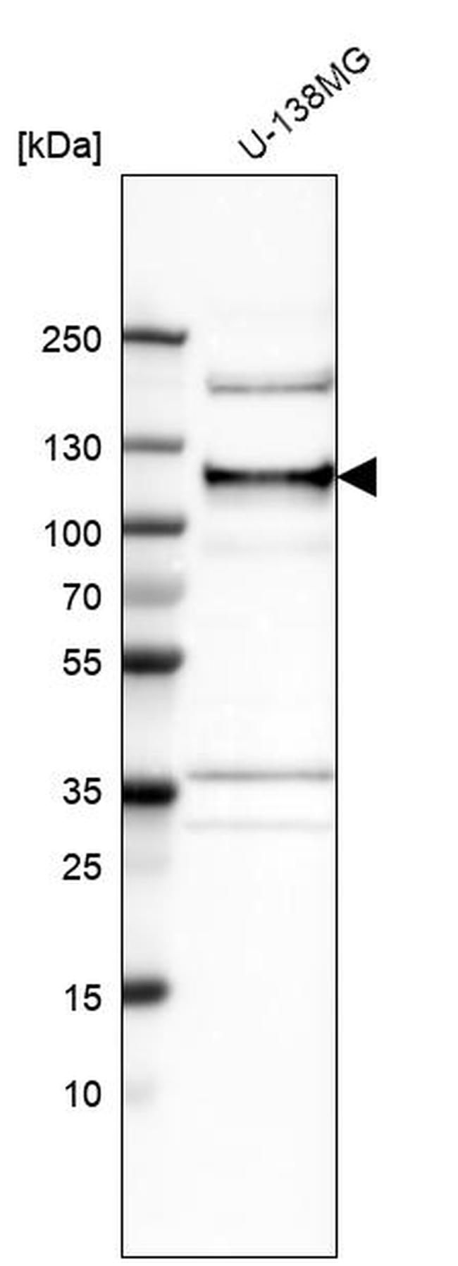 ANKLE2 Antibody in Western Blot (WB)
