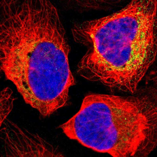 TIMM8A Antibody in Immunocytochemistry (ICC/IF)
