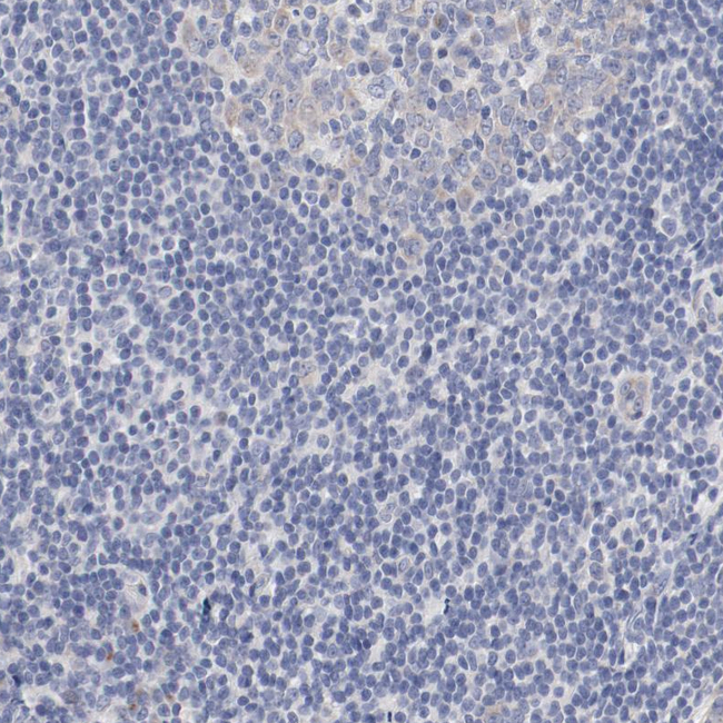 GPR143 Antibody in Immunohistochemistry (Paraffin) (IHC (P))