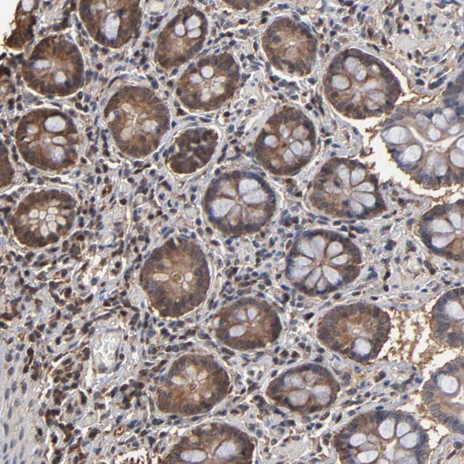 GS2 Antibody in Immunohistochemistry (Paraffin) (IHC (P))