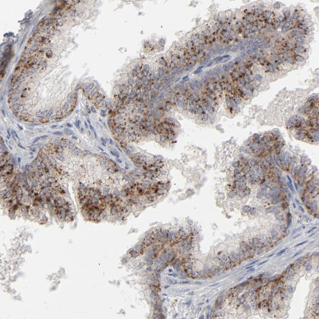 POMT2 Antibody in Immunohistochemistry (Paraffin) (IHC (P))