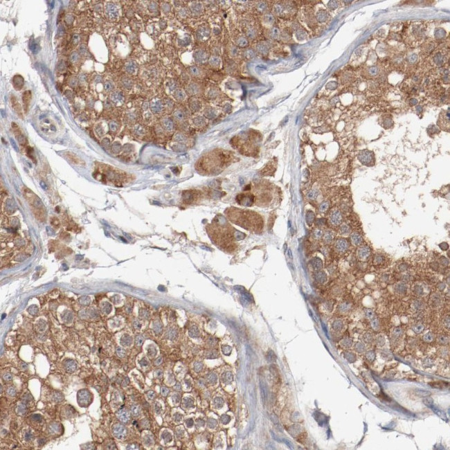 RNase11 Antibody in Immunohistochemistry (Paraffin) (IHC (P))