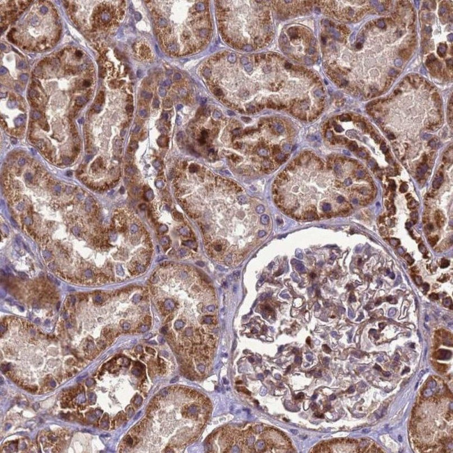 RSPRY1 Antibody in Immunohistochemistry (IHC)